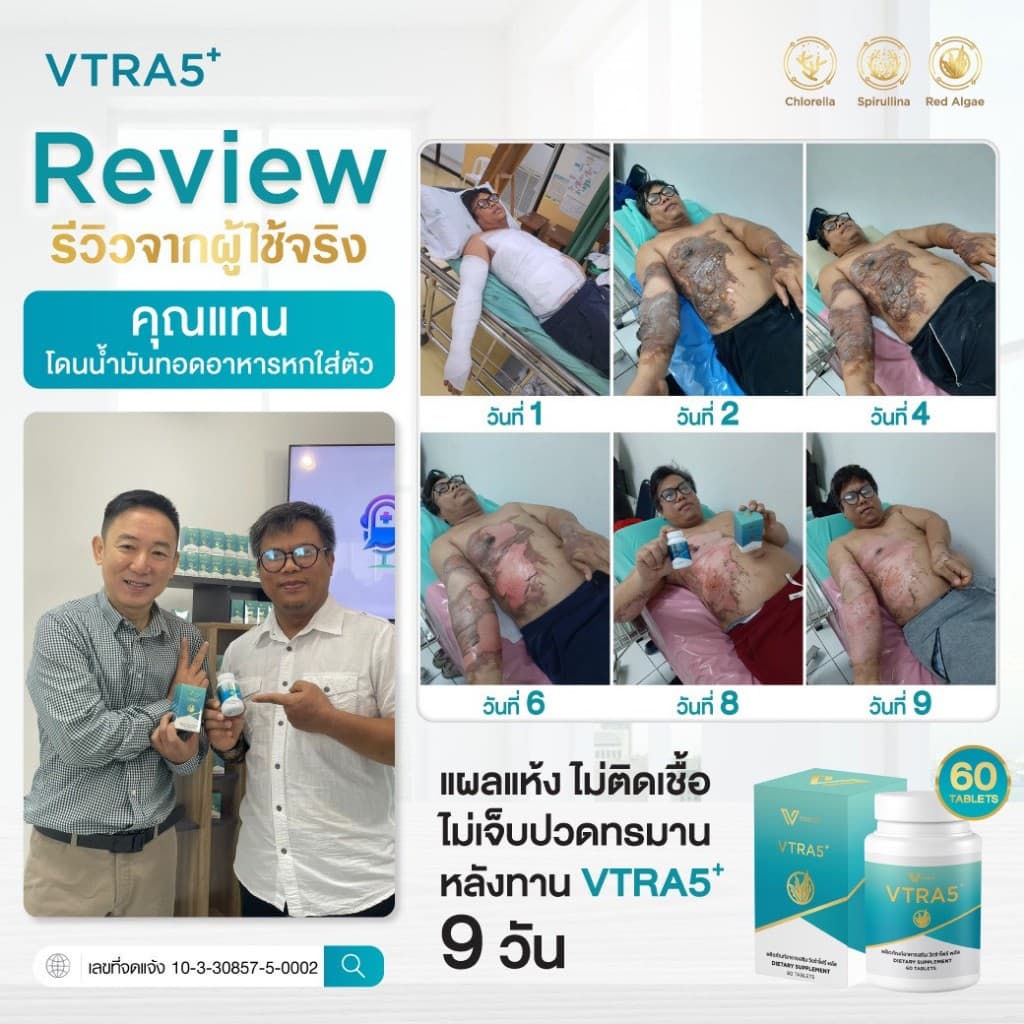 VTRA5 สามารถปรับสมดุลความผิดปกติของเซลล์ในกลุ่มโรค 3 กลุ่ม